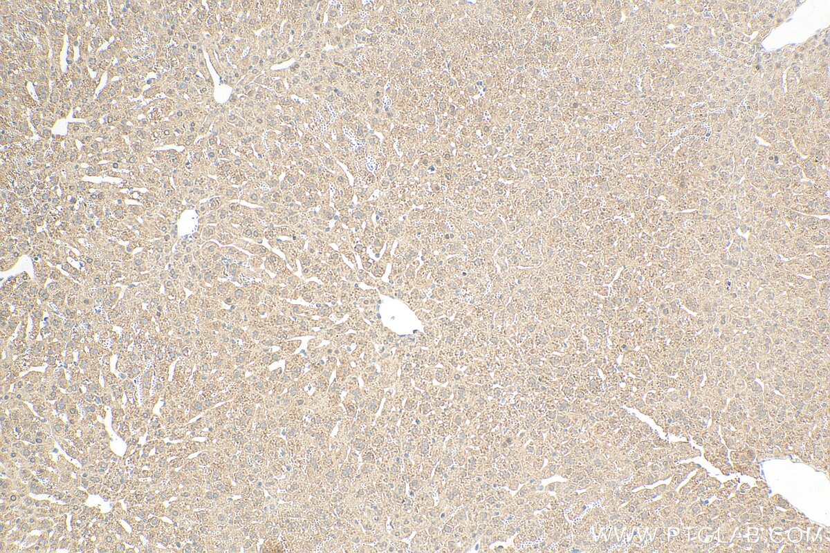 Immunohistochemistry (IHC) staining of mouse liver tissue using PSMB2 Monoclonal antibody (68180-1-Ig)