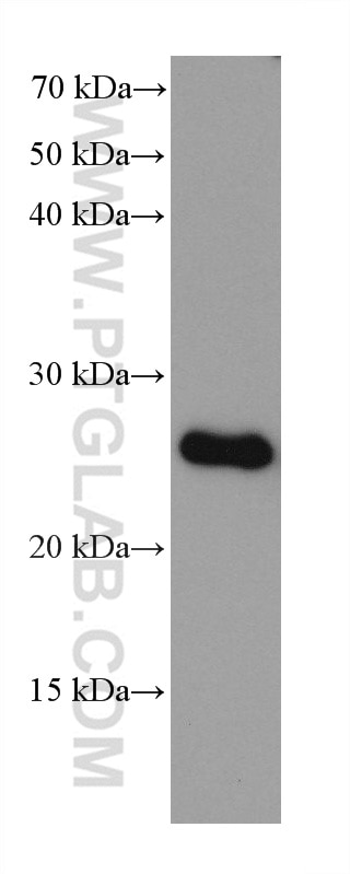 Western Blot (WB) analysis of various lysates using PSMB2 Monoclonal antibody (68180-1-Ig)