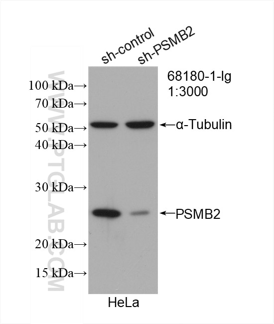 Western Blot (WB) analysis of HeLa cells using PSMB2 Monoclonal antibody (68180-1-Ig)