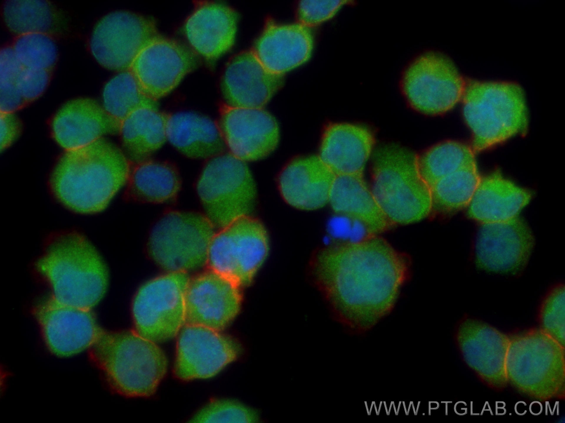 Immunofluorescence (IF) / fluorescent staining of Jurkat cells using PSMB3 Polyclonal antibody (15983-1-AP)