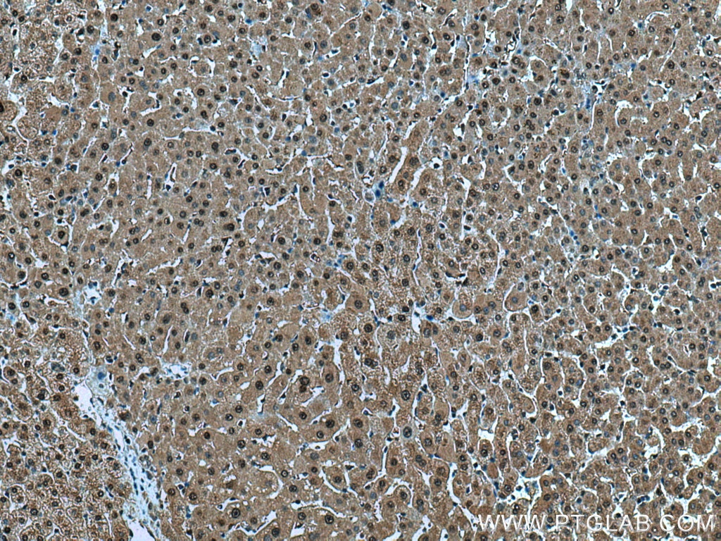 Immunohistochemistry (IHC) staining of human liver tissue using PSMB3 Polyclonal antibody (15983-1-AP)