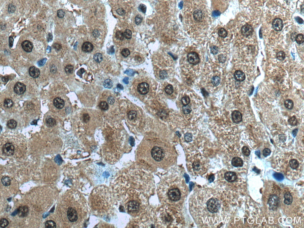 Immunohistochemistry (IHC) staining of human liver tissue using PSMB3 Polyclonal antibody (15983-1-AP)