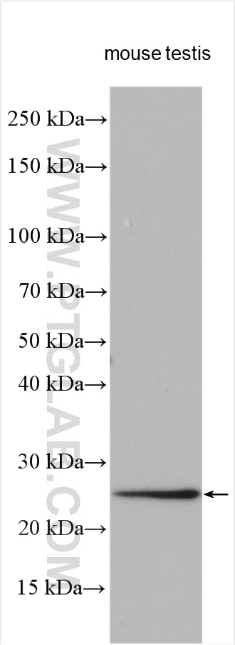 Western Blot (WB) analysis of various lysates using PSMB3 Polyclonal antibody (15983-1-AP)