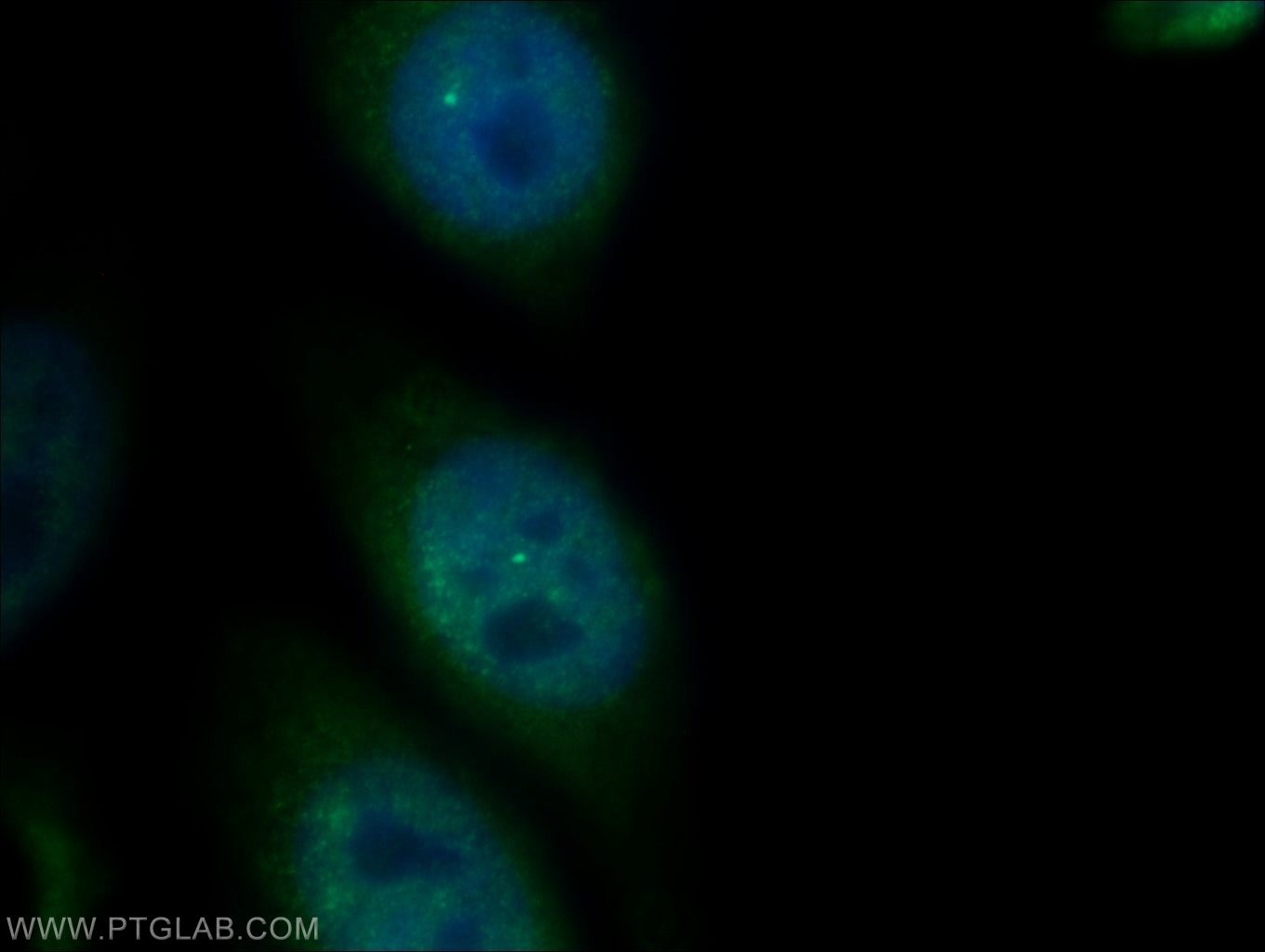 Immunofluorescence (IF) / fluorescent staining of HepG2 cells using PSMB4 Polyclonal antibody (11029-1-AP)