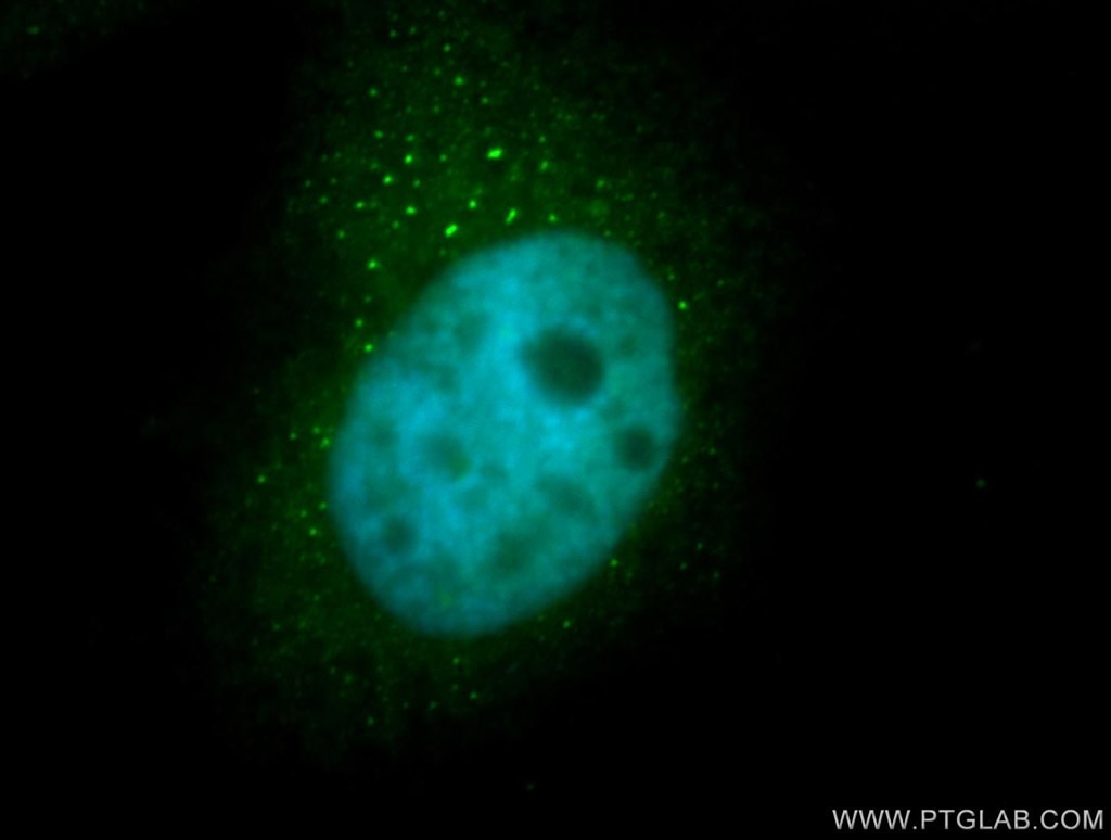 Immunofluorescence (IF) / fluorescent staining of MCF-7 cells using PSMB4 Polyclonal antibody (11029-1-AP)