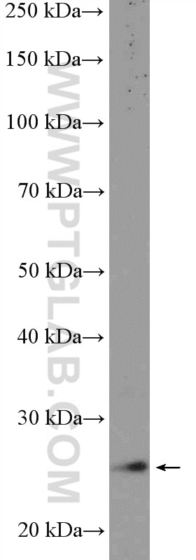 Western Blot (WB) analysis of mouse skeletal muscle tissue using PSMB4 Polyclonal antibody (11029-1-AP)