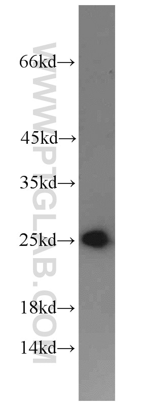 Western Blot (WB) analysis of human placenta tissue using PSMB4 Polyclonal antibody (11029-1-AP)