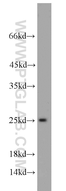 Western Blot (WB) analysis of human skeletal muscle tissue using PSMB4 Polyclonal antibody (11029-1-AP)