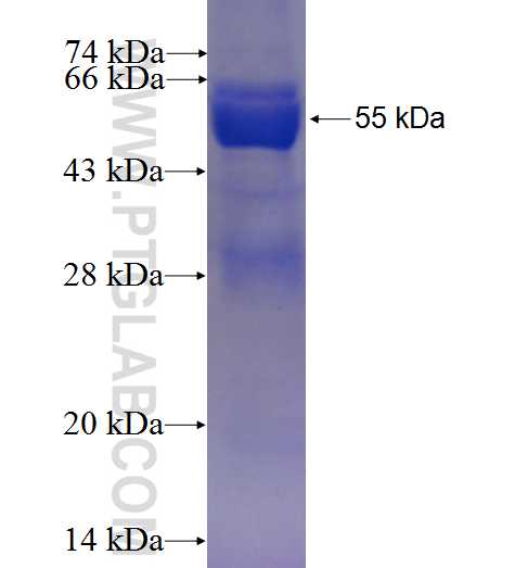 PSMB4 fusion protein Ag1500 SDS-PAGE