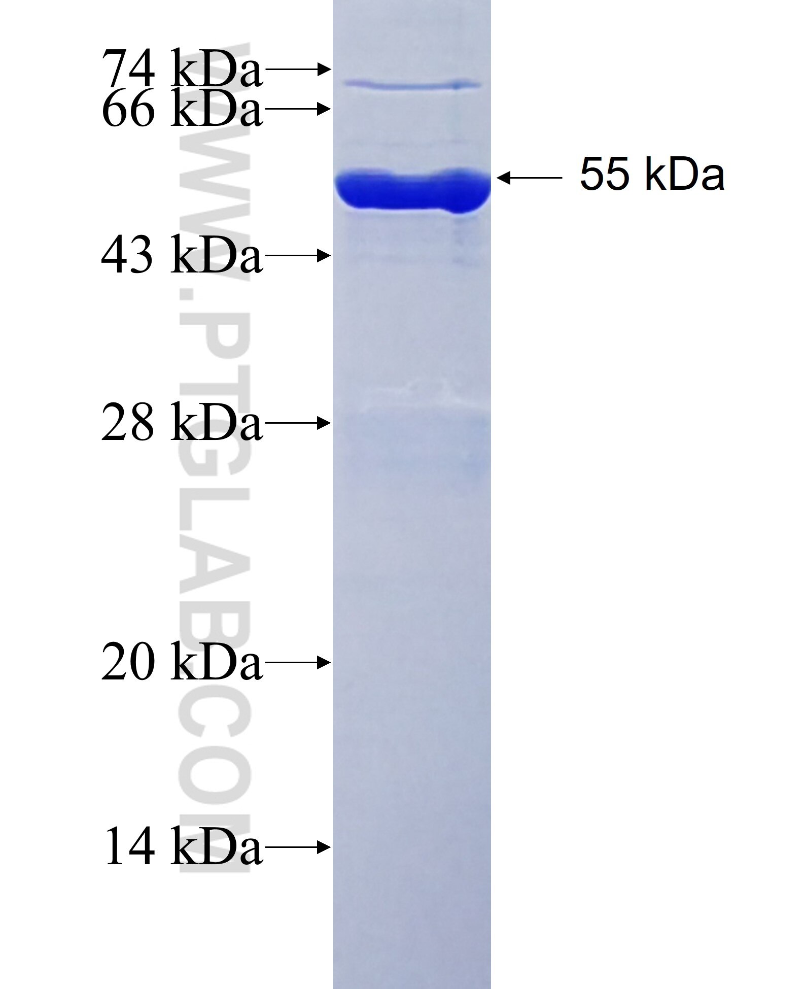 PSMB4 fusion protein Ag1500 SDS-PAGE