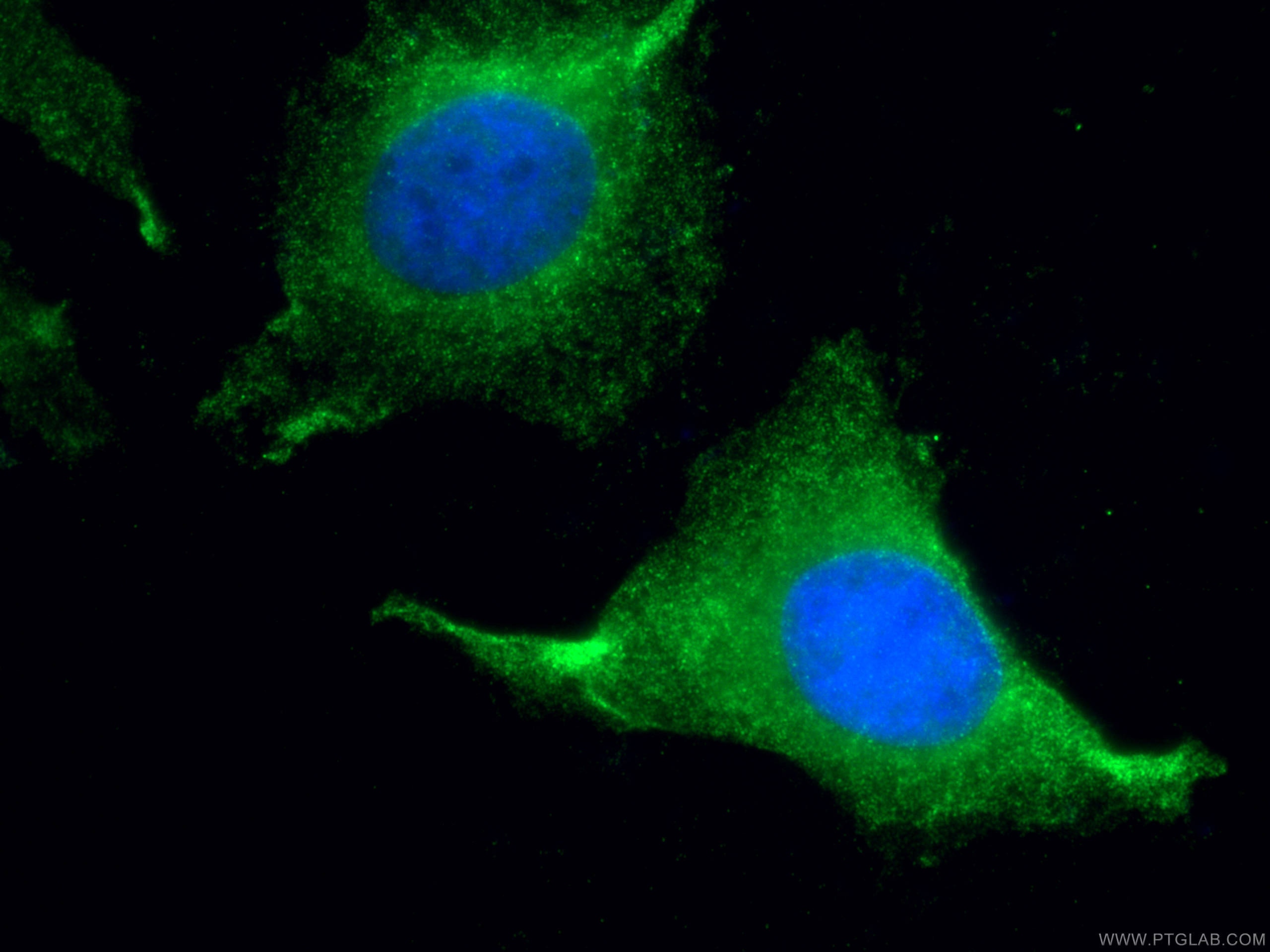 Immunofluorescence (IF) / fluorescent staining of HeLa cells using PSMB5 Polyclonal antibody (19178-1-AP)