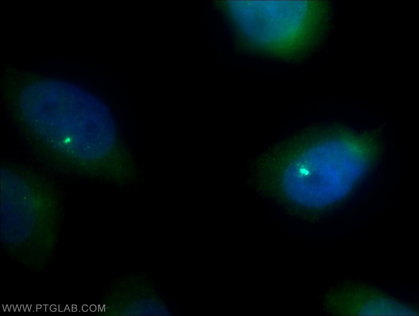 PSMB5 Polyclonal antibody