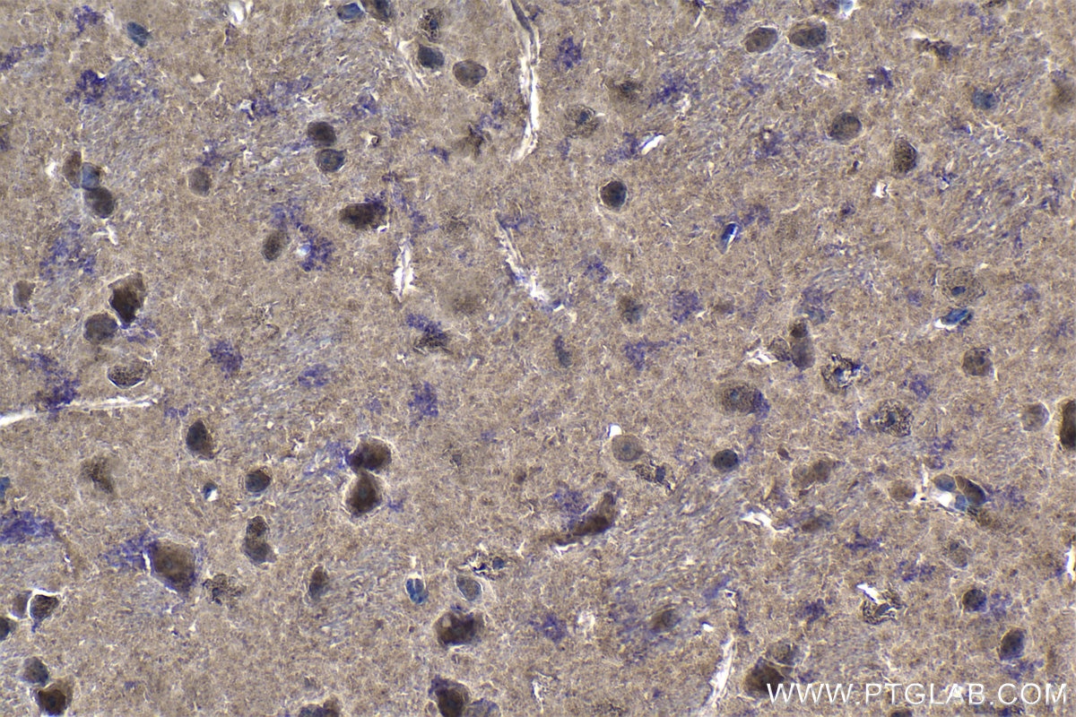 IHC staining of mouse brain using 19178-1-AP Immunohistochemistry (IHC) staining of mouse brain tissue using PSMB5 Polyclonal antibody (19178-1-AP)