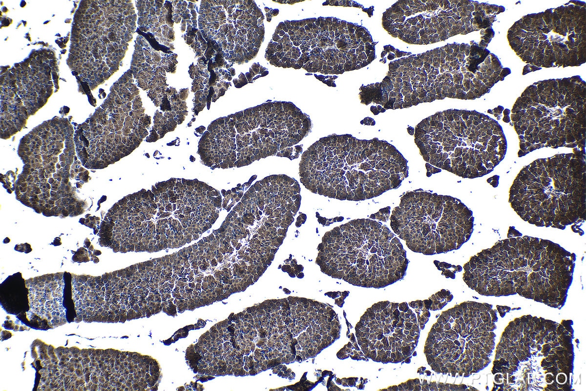 IHC staining of mouse testis using 19178-1-AP Immunohistochemistry (IHC) staining of mouse testis tissue using PSMB5 Polyclonal antibody (19178-1-AP)
