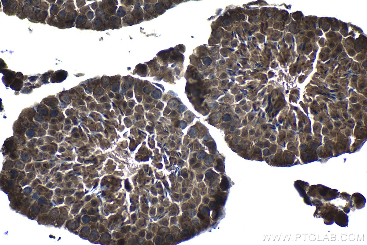 IHC staining of mouse testis using 19178-1-AP Immunohistochemistry (IHC) staining of mouse testis tissue using PSMB5 Polyclonal antibody (19178-1-AP)