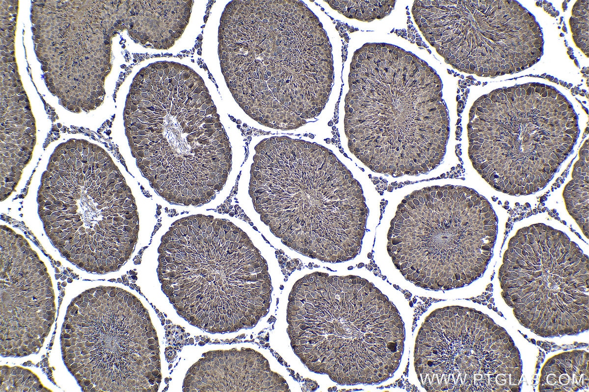 IHC staining of rat testis using 19178-1-AP Immunohistochemistry (IHC) staining of rat testis tissue using PSMB5 Polyclonal antibody (19178-1-AP)