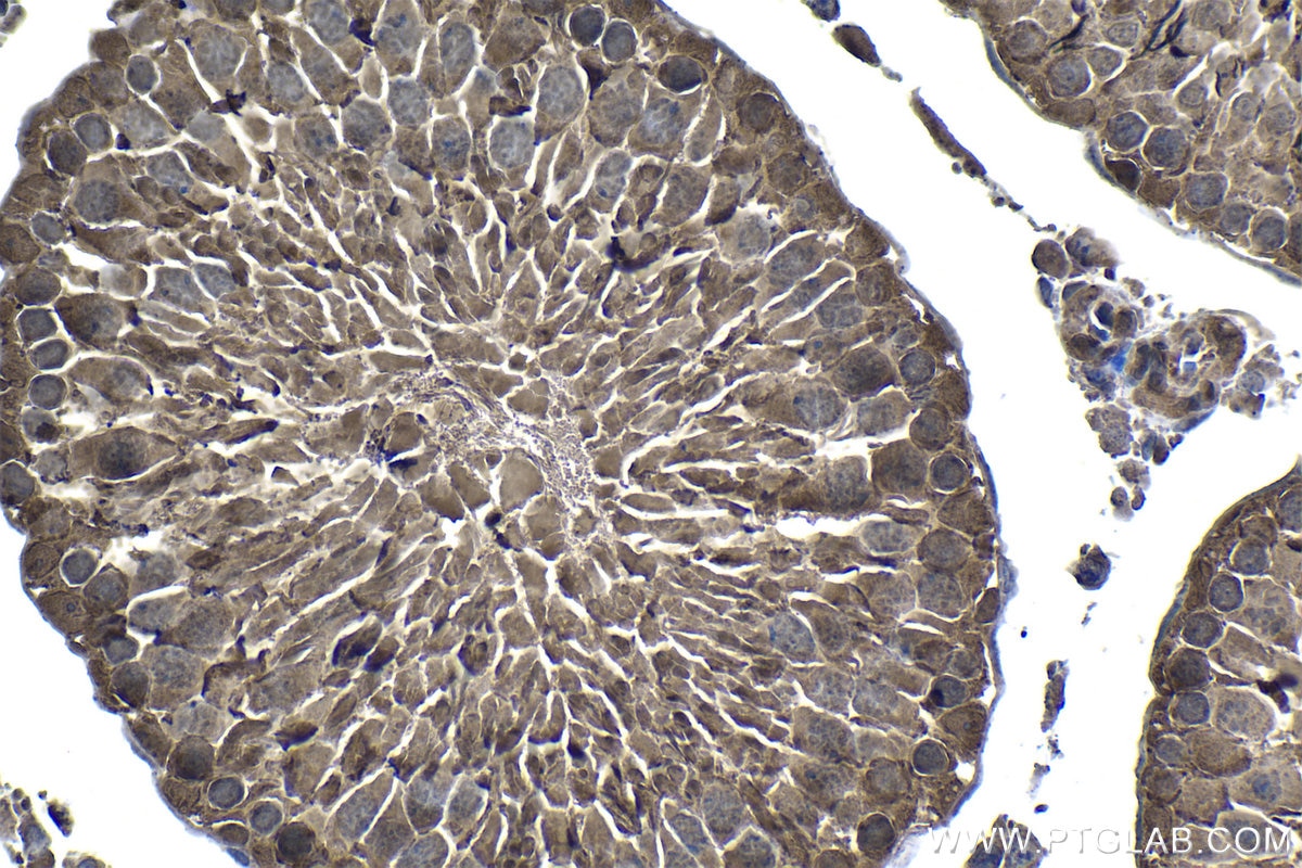 IHC staining of rat testis using 19178-1-AP Immunohistochemistry (IHC) staining of rat testis tissue using PSMB5 Polyclonal antibody (19178-1-AP)
