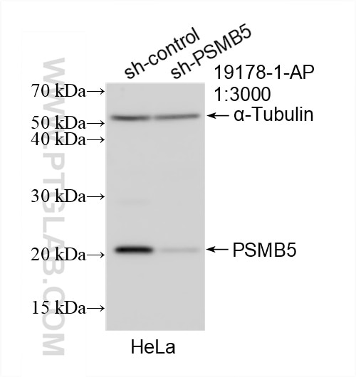 Western Blot (WB) analysis of HeLa cells using PSMB5 Polyclonal antibody (19178-1-AP)