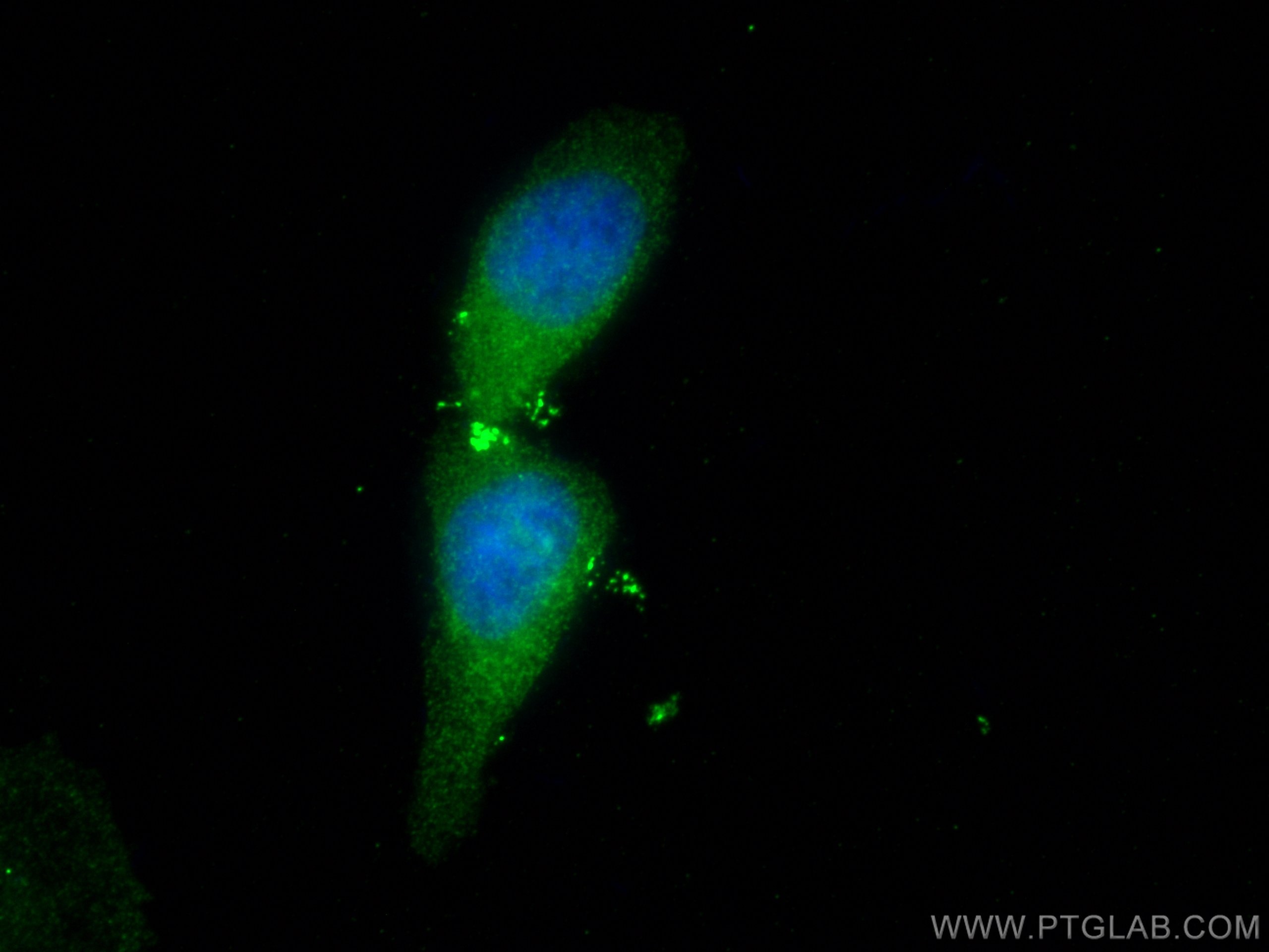 Immunofluorescence (IF) / fluorescent staining of HeLa cells using PSMB5 Monoclonal antibody (67959-1-Ig)