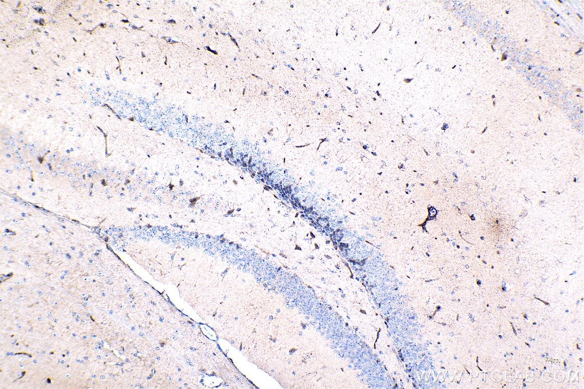 Immunohistochemistry (IHC) staining of mouse brain tissue using PSMB5 Monoclonal antibody (67959-1-Ig)
