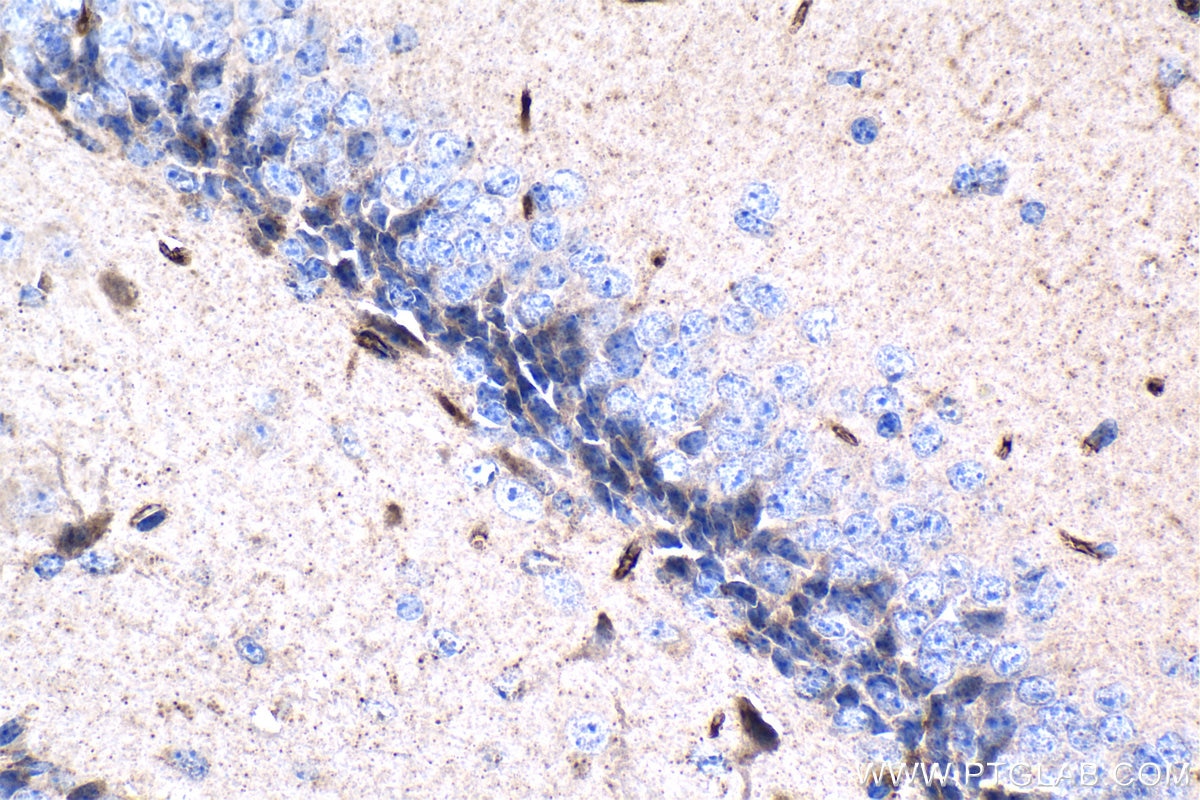 Immunohistochemistry (IHC) staining of mouse brain tissue using PSMB5 Monoclonal antibody (67959-1-Ig)