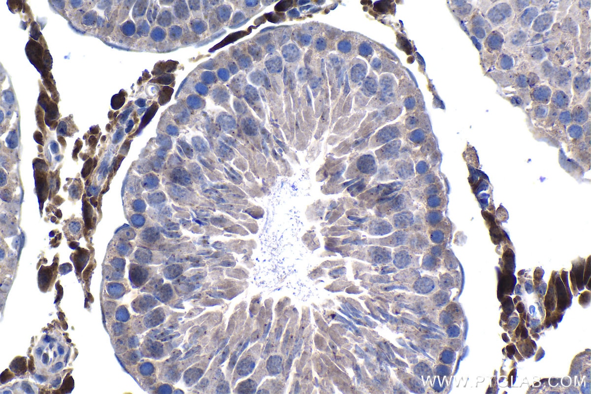 Immunohistochemistry (IHC) staining of rat testis tissue using PSMB5 Monoclonal antibody (67959-1-Ig)