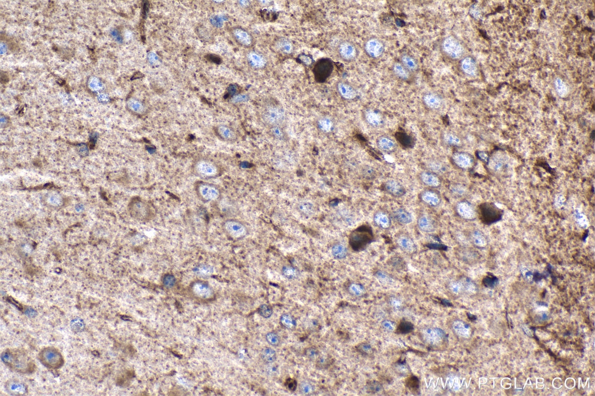 Immunohistochemistry (IHC) staining of mouse brain tissue using PSMB5 Monoclonal antibody (67959-1-Ig)
