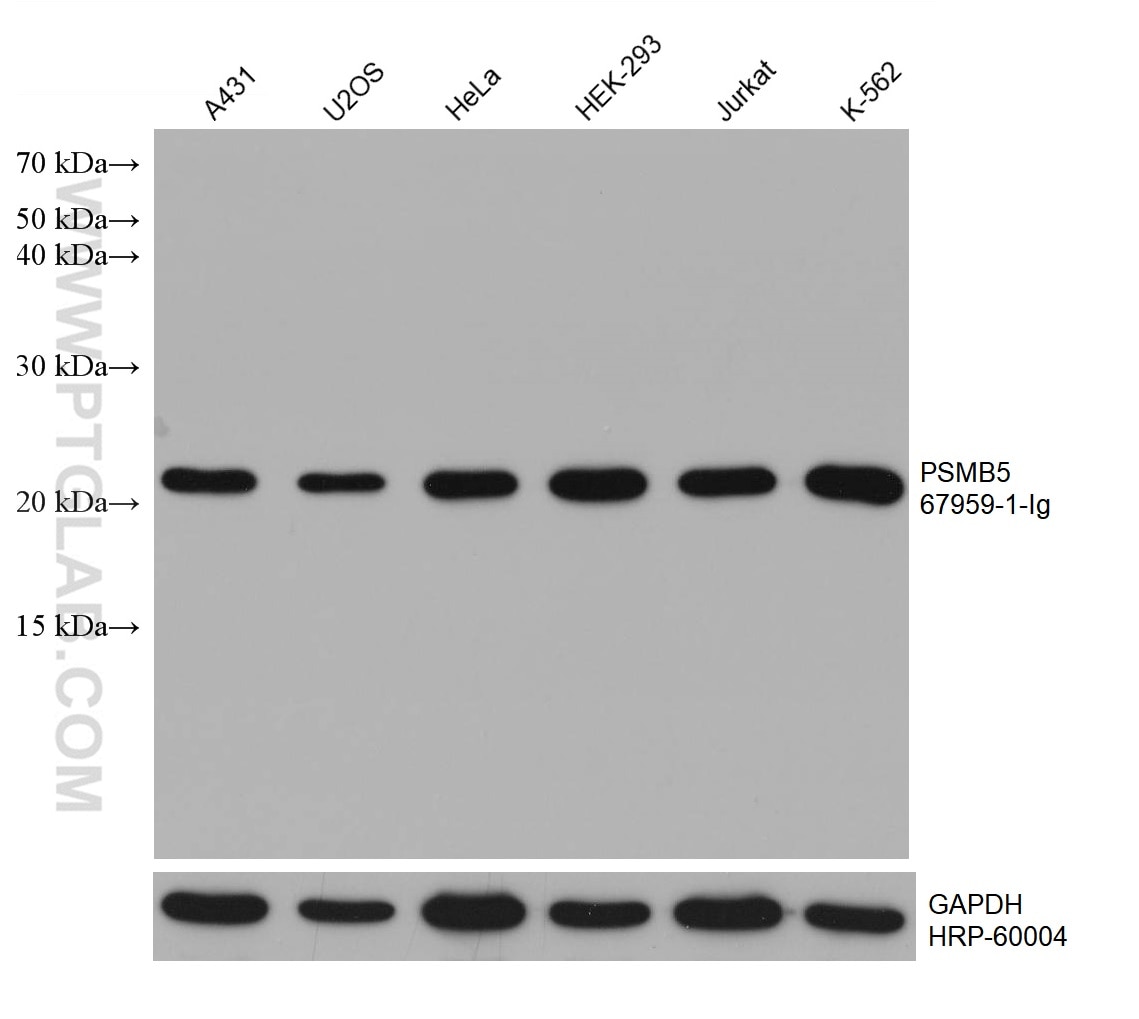 WB analysis using 67959-1-Ig