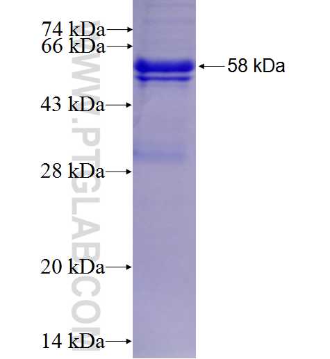 PSMB5 fusion protein Ag5230 SDS-PAGE