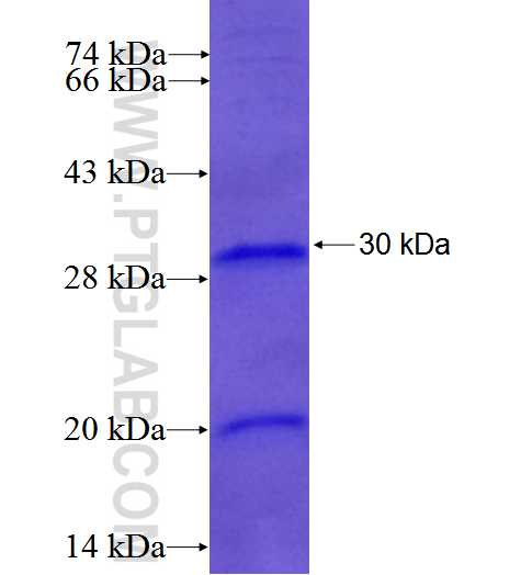 PSMB5 fusion protein Ag5828 SDS-PAGE