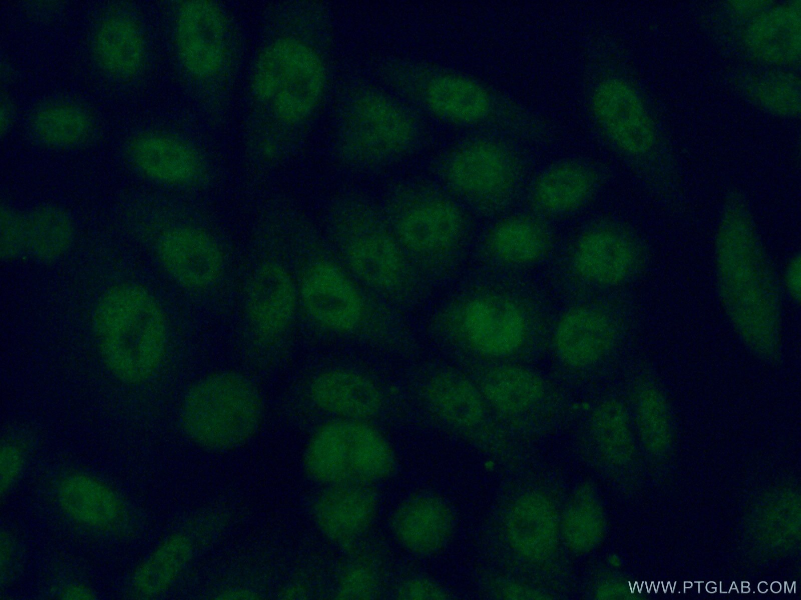Immunofluorescence (IF) / fluorescent staining of HeLa cells using PSMB6 Polyclonal antibody (11684-2-AP)