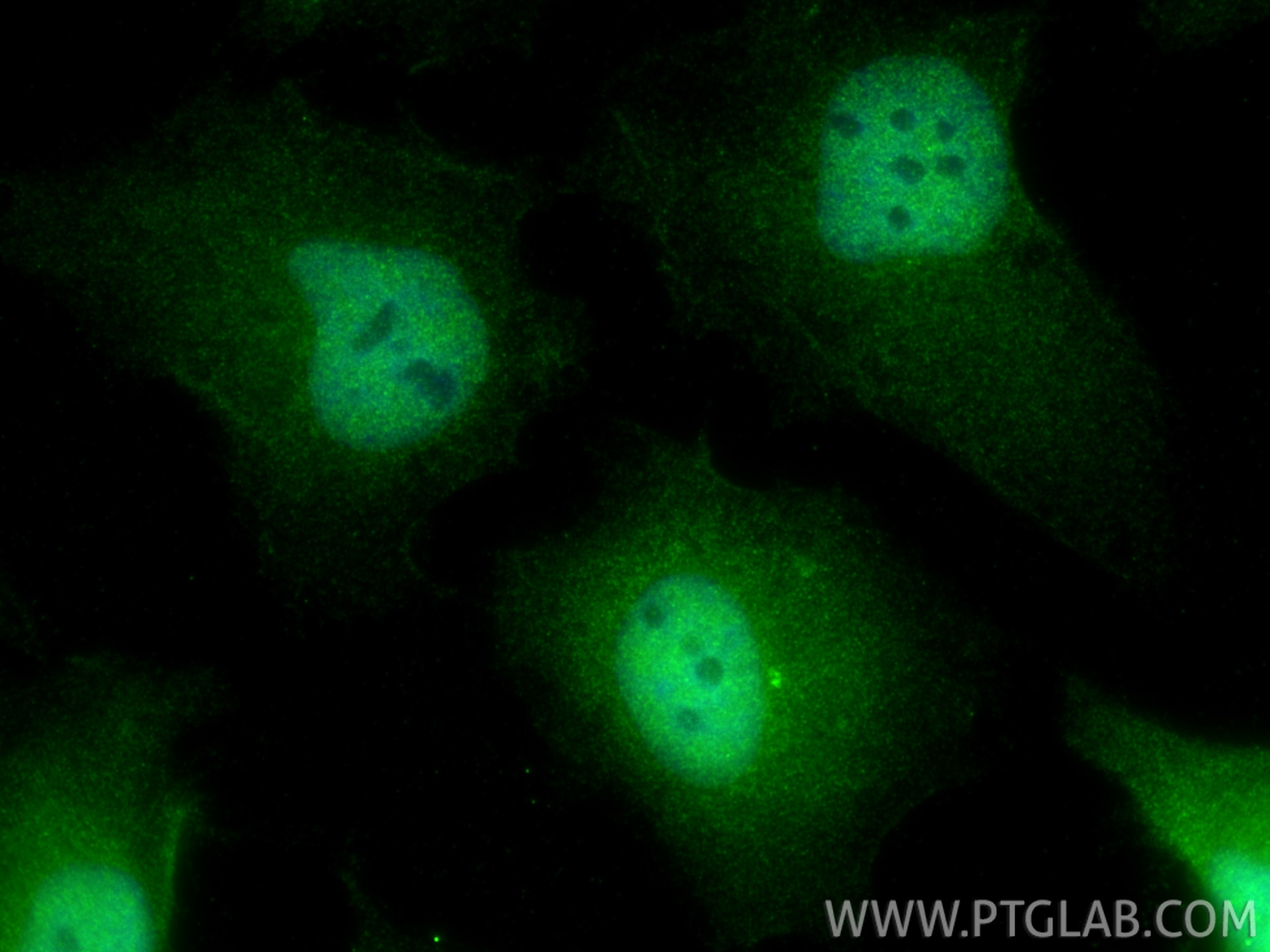 Immunofluorescence (IF) / fluorescent staining of HeLa cells using PSMB6 Polyclonal antibody (11684-2-AP)