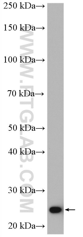 Western Blot (WB) analysis of fetal human brain tissue using PSMB6 Polyclonal antibody (11684-2-AP)