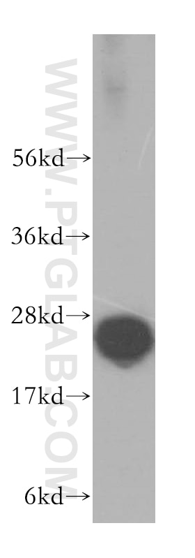 Western Blot (WB) analysis of human brain tissue using PSMB6 Polyclonal antibody (11684-2-AP)