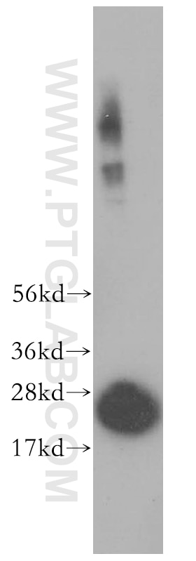 Western Blot (WB) analysis of HeLa cells using PSMB6 Polyclonal antibody (11684-2-AP)