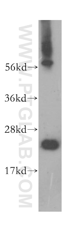 Western Blot (WB) analysis of human liver tissue using PSMB6 Polyclonal antibody (11684-2-AP)