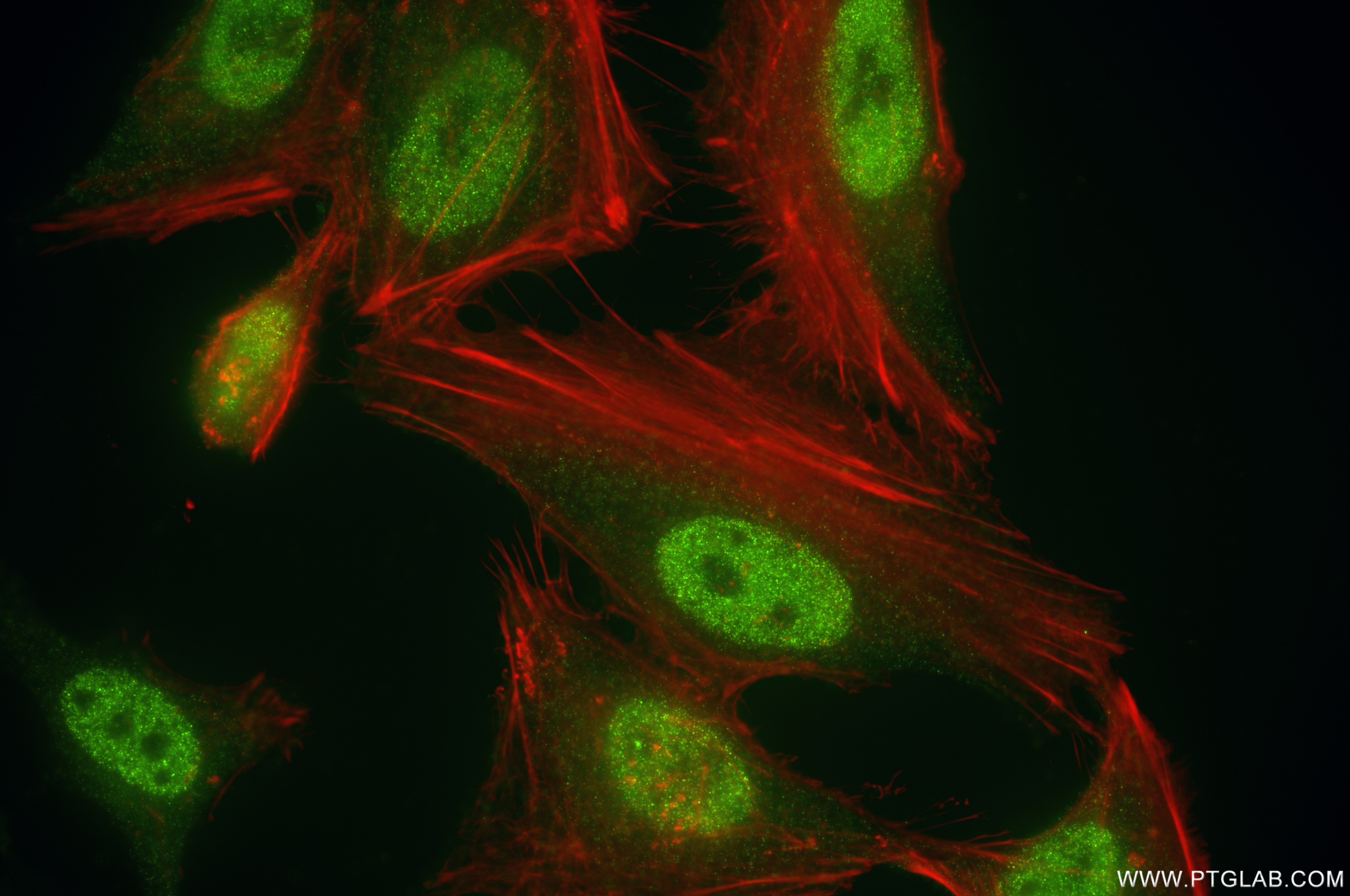 Immunofluorescence (IF) / fluorescent staining of HeLa cells using PSMB6 Recombinant antibody (86491-1-RR)