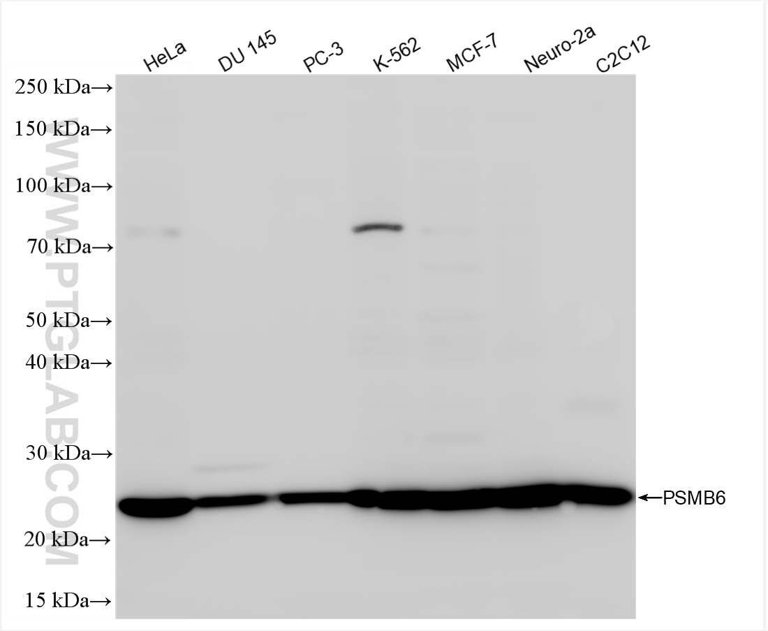 Western Blot (WB) analysis of various lysates using PSMB6 Recombinant antibody (86491-1-RR)