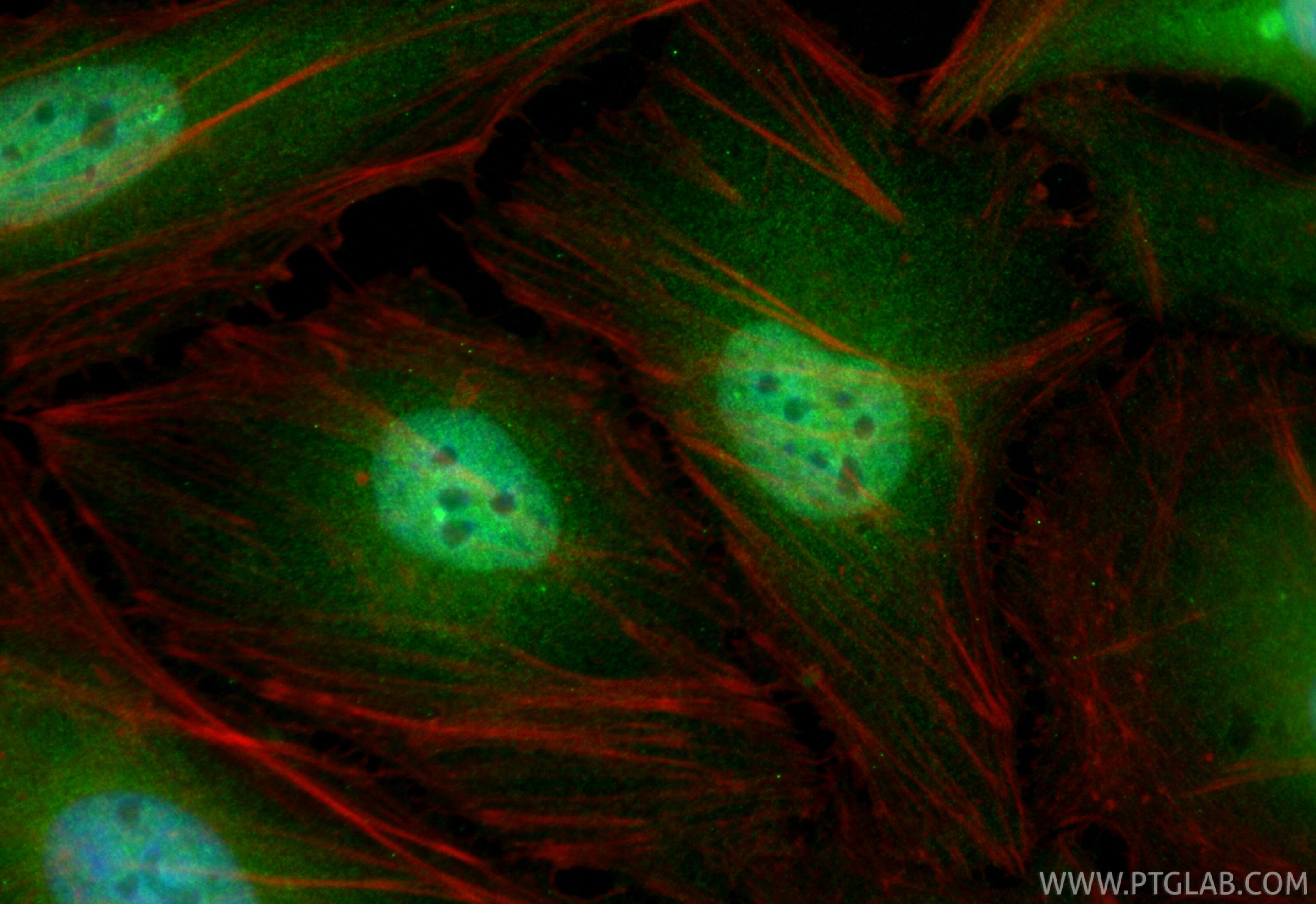 Immunofluorescence (IF) / fluorescent staining of HeLa cells using CoraLite® Plus 488-conjugated PSMB6 Recombinant mo (CL488-86491)