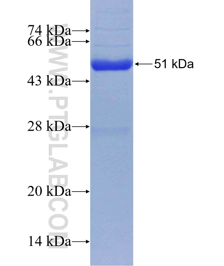 PSMB6 fusion protein Ag2296 SDS-PAGE