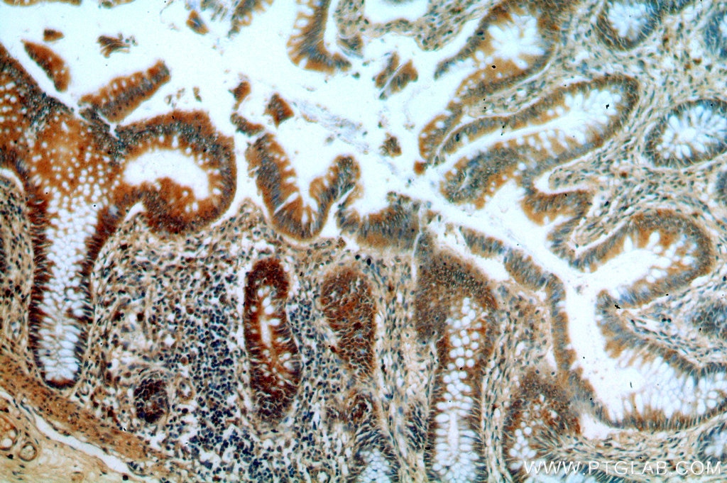 Immunohistochemistry (IHC) staining of human colon tissue using PSMB7 Polyclonal antibody (14727-1-AP)