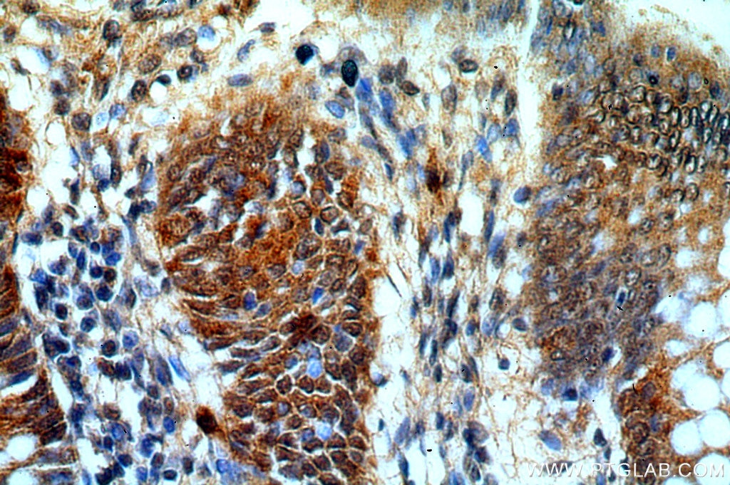 Immunohistochemistry (IHC) staining of human colon tissue using PSMB7 Polyclonal antibody (14727-1-AP)