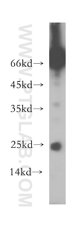 Western Blot (WB) analysis of Raji cells using PSMB7 Polyclonal antibody (14727-1-AP)