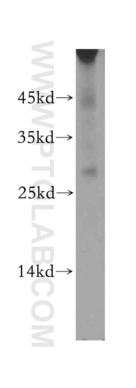 Western Blot (WB) analysis of Raji cells using PSMB7 Polyclonal antibody (14727-1-AP)