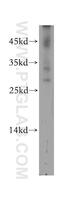 Western Blot (WB) analysis of A549 cells using PSMB7 Polyclonal antibody (14727-1-AP)