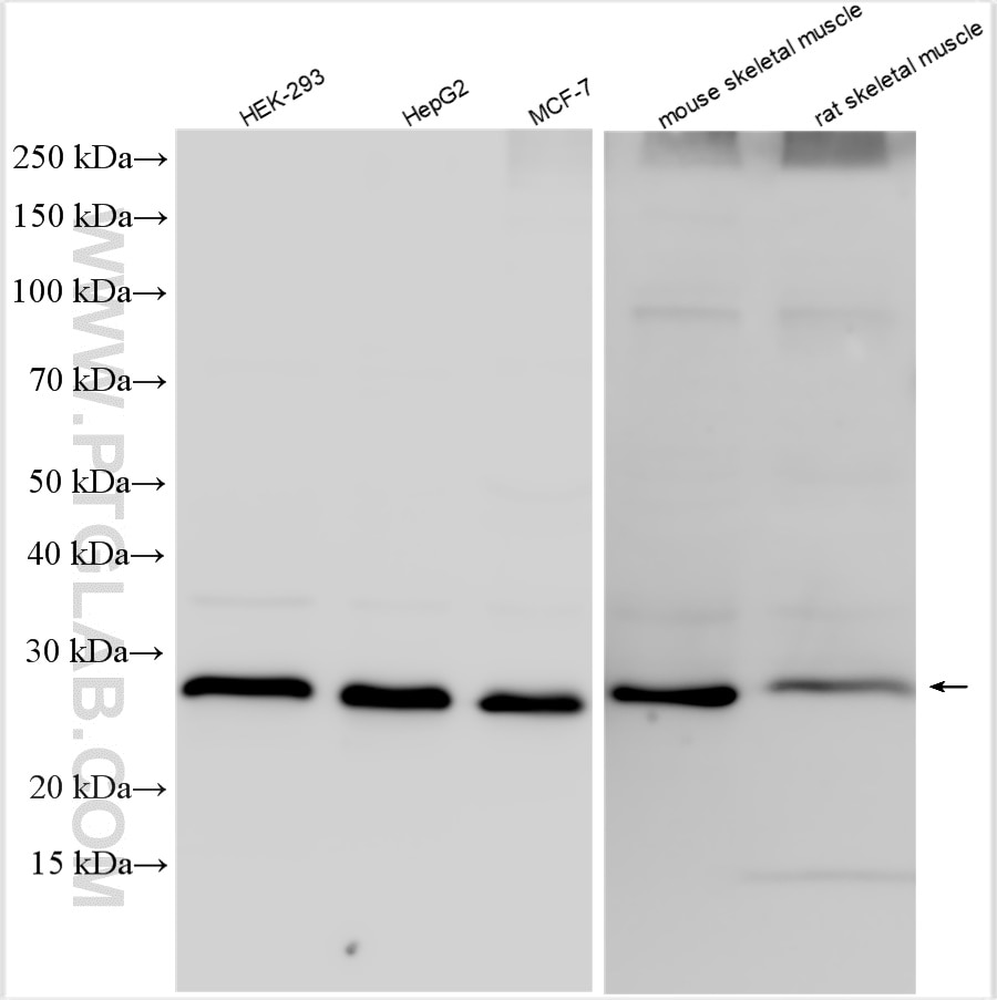 Western Blot (WB) analysis of various lysates using PSMB7 Polyclonal antibody (30283-1-AP)