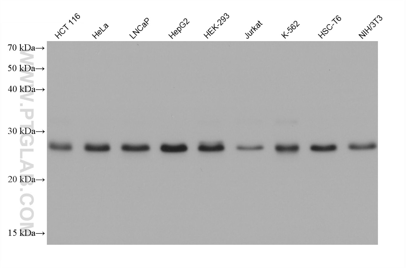 WB analysis using 68641-1-Ig