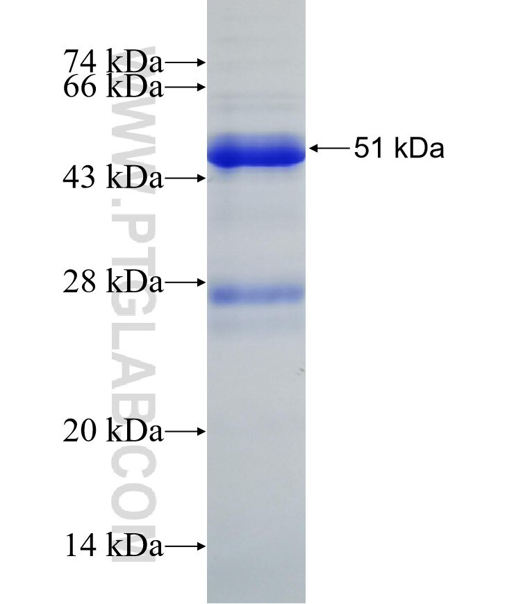 PSMB7 fusion protein Ag32201 SDS-PAGE