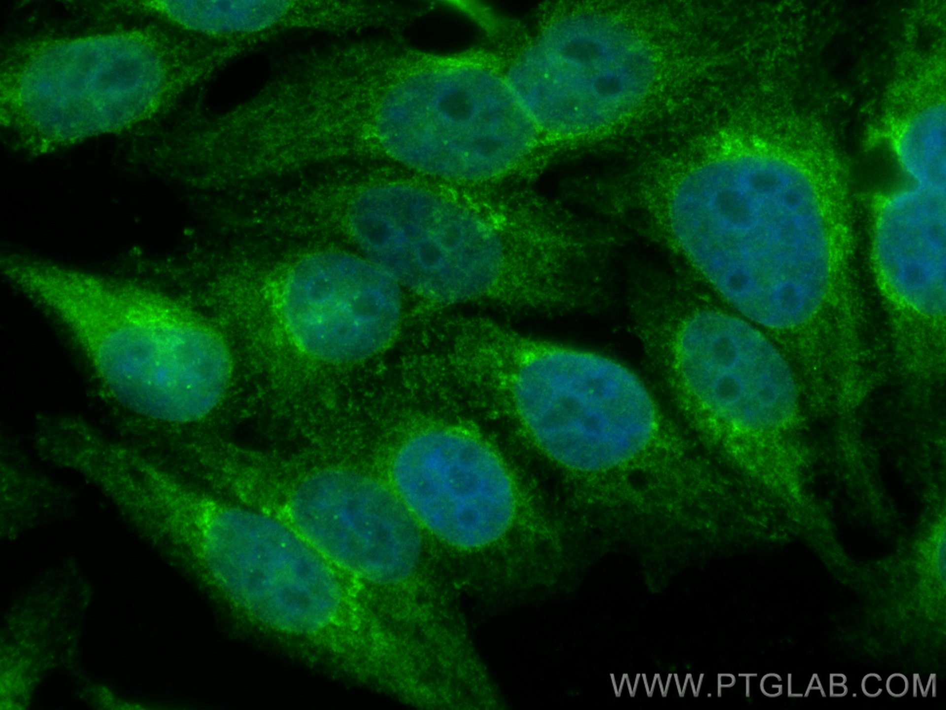 Immunofluorescence (IF) / fluorescent staining of HepG2 cells using PSMB8 Polyclonal antibody (14859-1-AP)