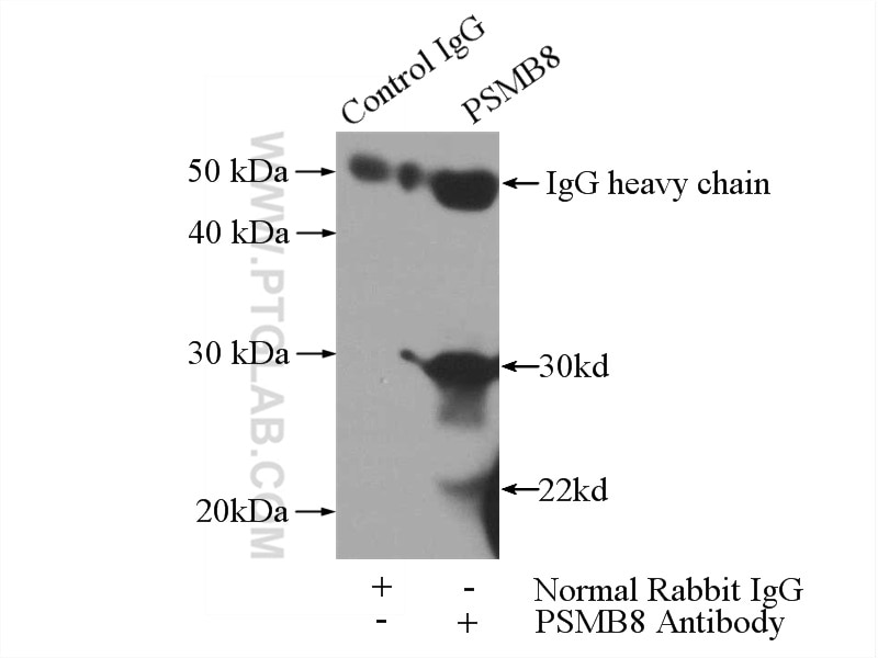 Immunoprecipitation (IP) experiment of Raji cells using PSMB8 Polyclonal antibody (14859-1-AP)